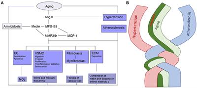 Is Vascular Amyloidosis Intertwined with Arterial Aging, Hypertension and Atherosclerosis?